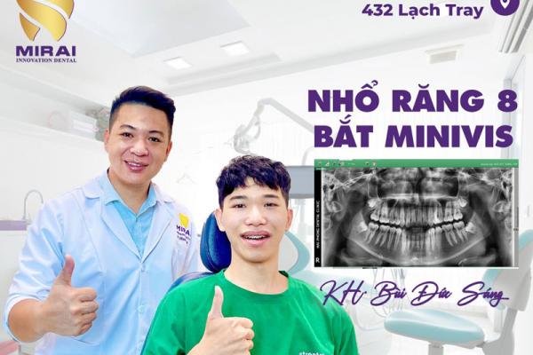   
          Nhổ răng không có đau không?