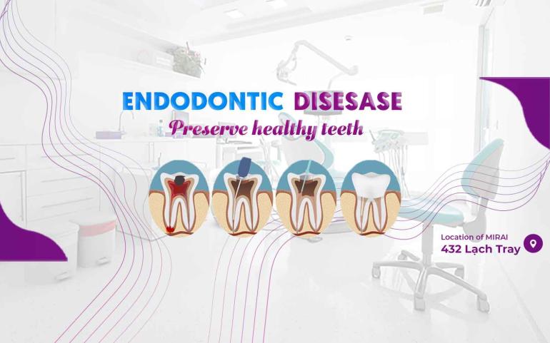 Endodontic disease