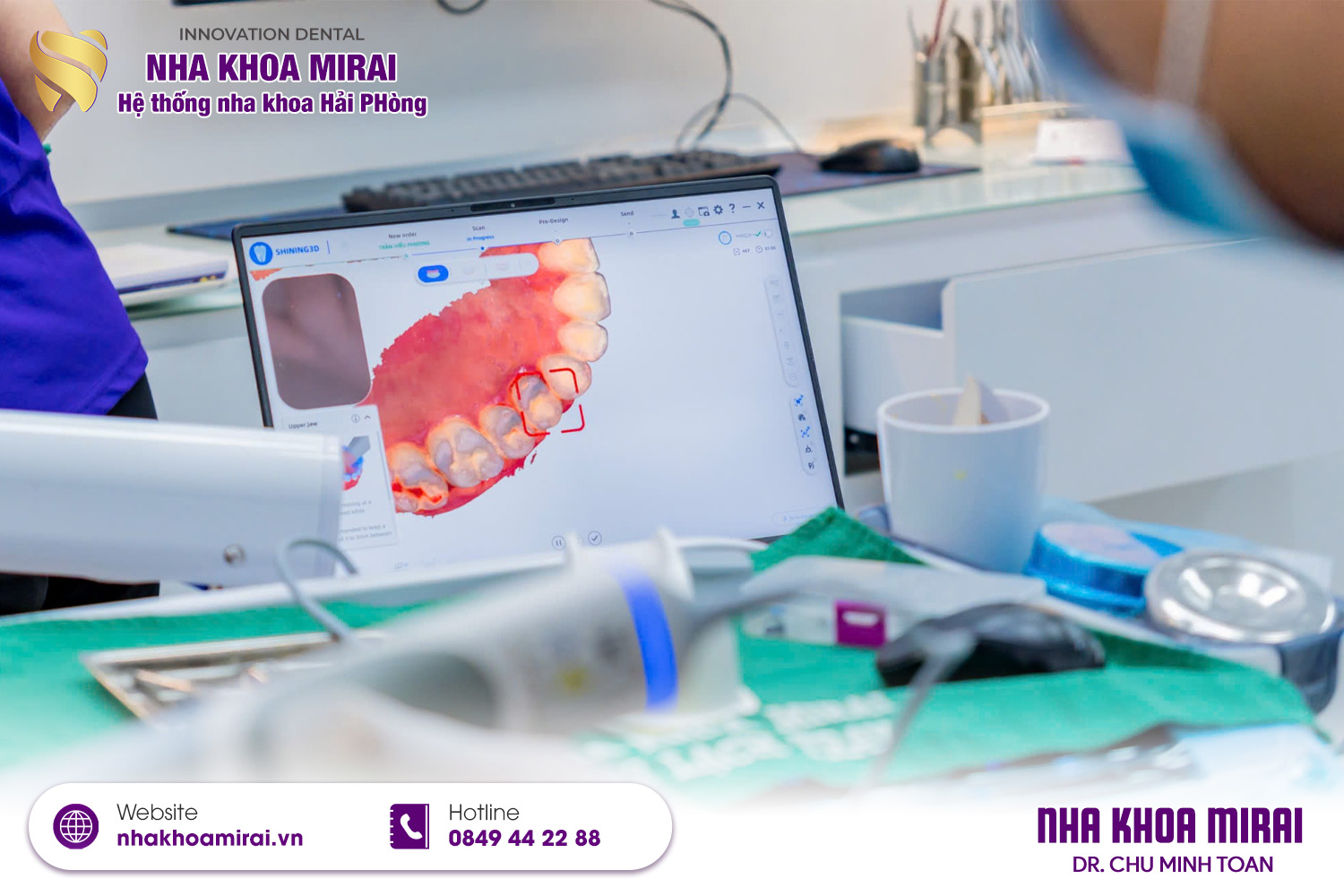 Nha khoa MIRAI trang bị máy móc hiện đại