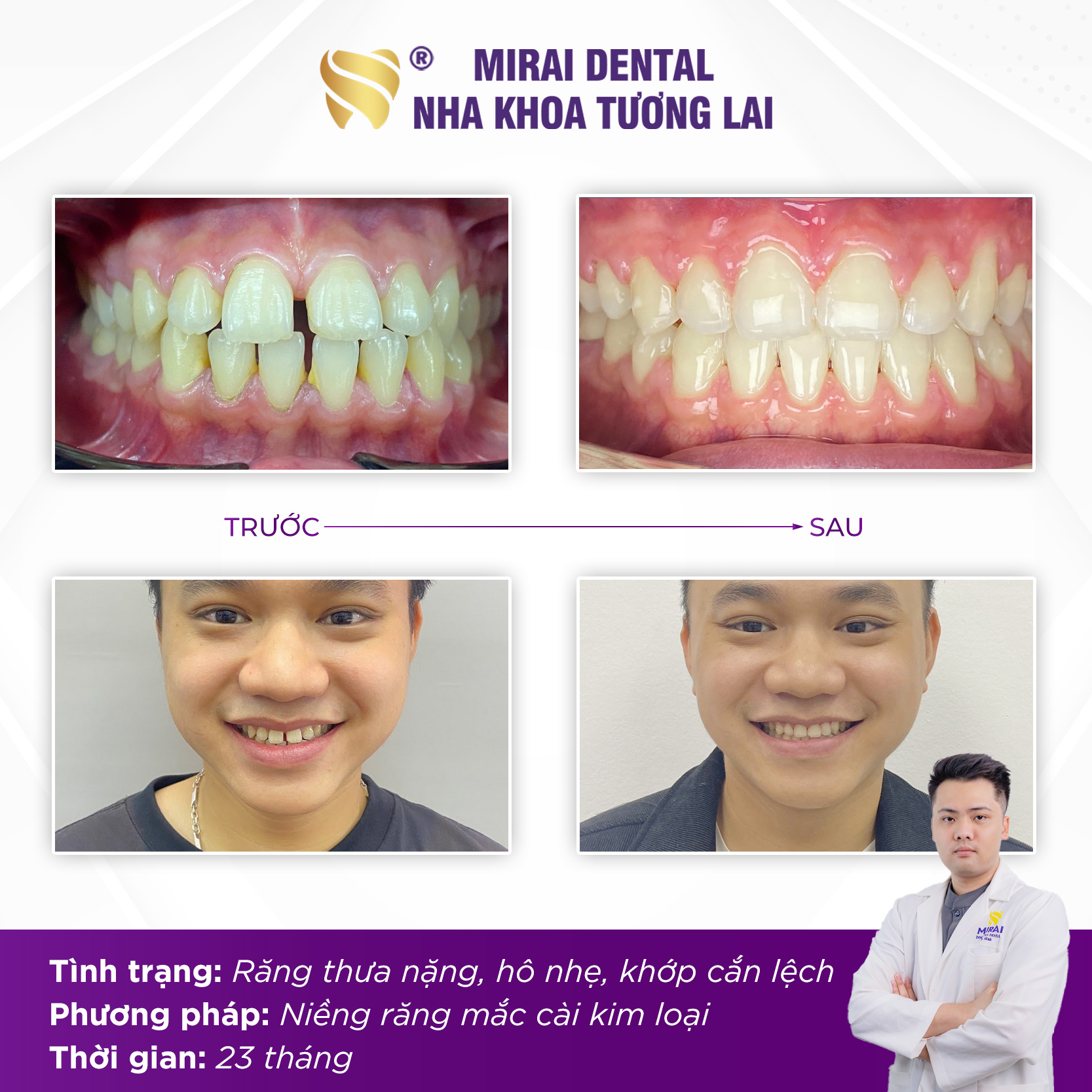 Bác sĩ nha khoa Trần Lê Minh - Bác sĩ chỉnh nha tại nha khoa Tương Lai