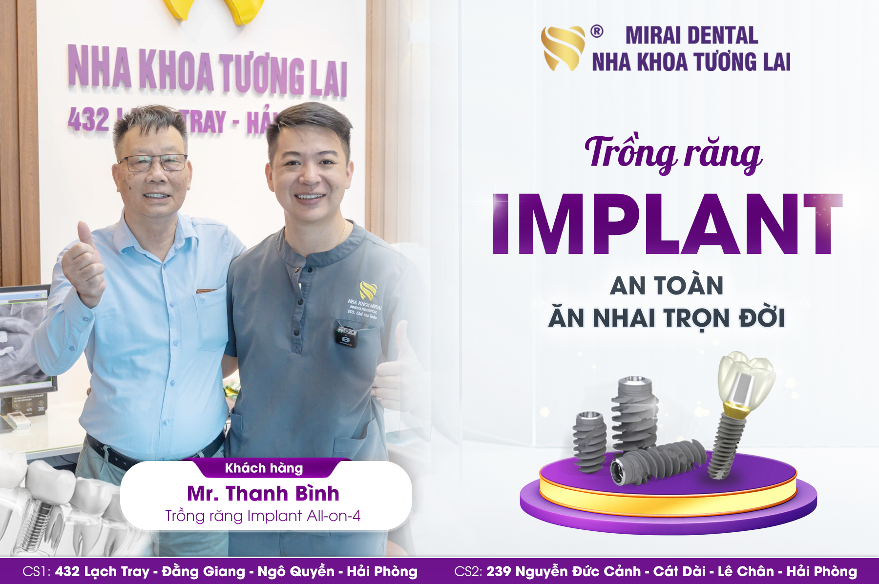 Trồng răng Implant giá bao nhiêu? Tìm hiểu cùng Mirai Dental Trồng răng Implant giá bao nhiêu? Tìm hiểu cùng Mirai Dental