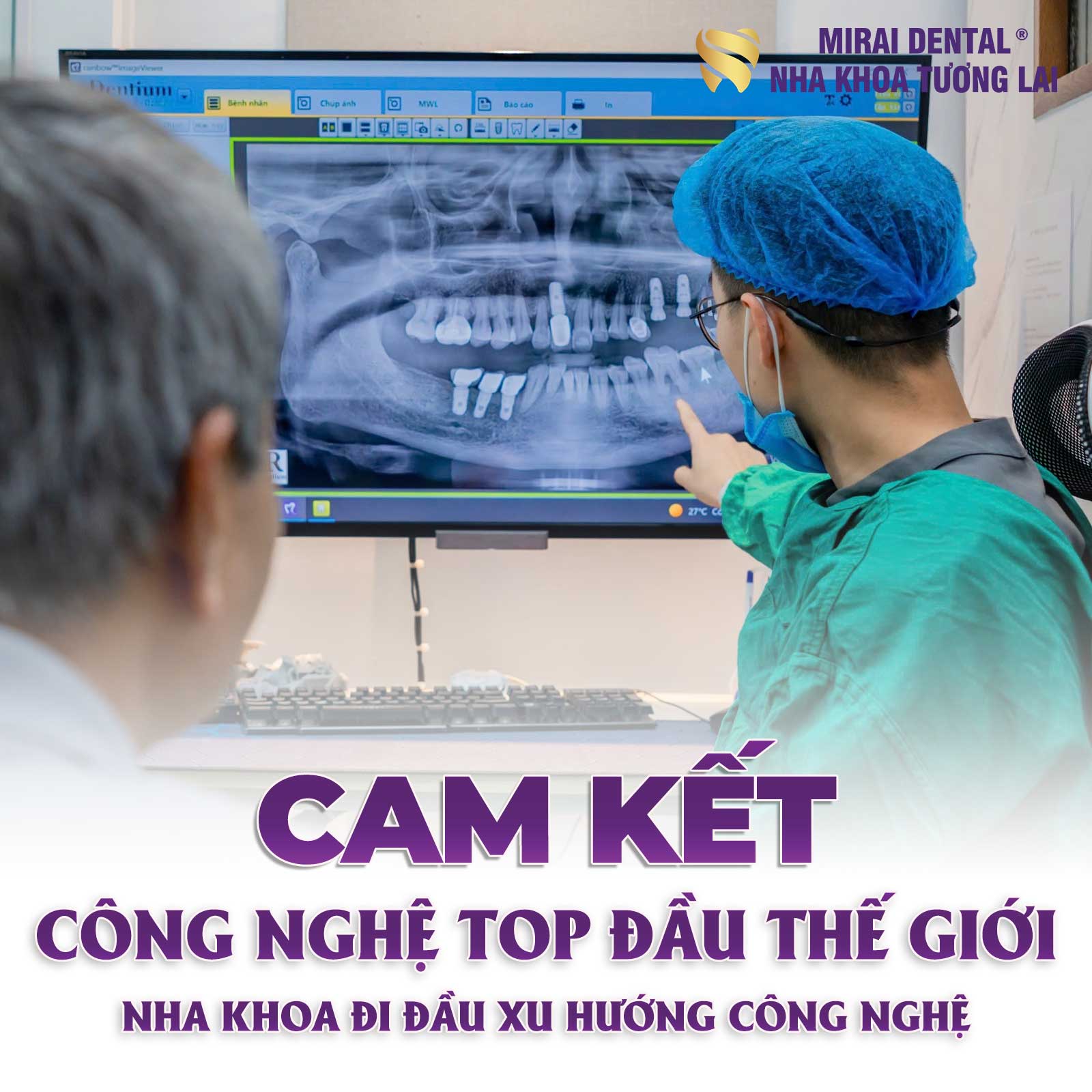 Trồng răng Implant