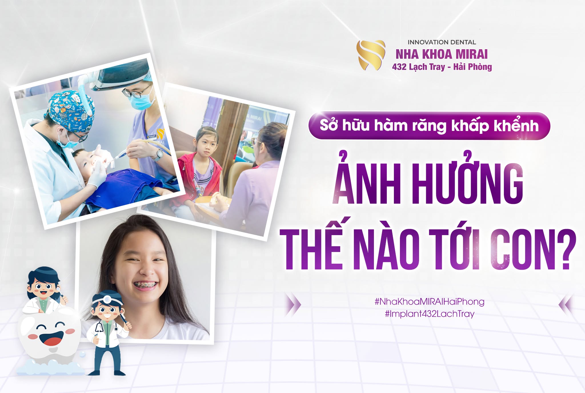 Niềng Răng Không Nhổ Răng Cho Trẻ Niềng Răng Không Nhổ Răng Cho Trẻ