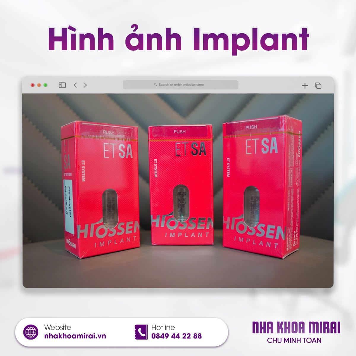 Hình ảnh implant Hiossen Mỹ